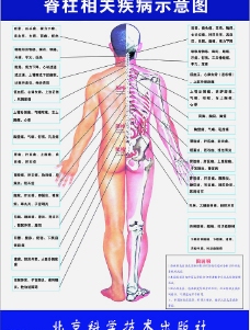脊柱相关疾病示意图图片